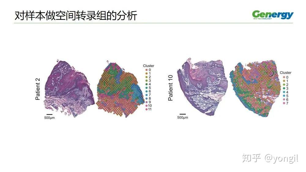 单细胞测序结合visium空间转录组多模式分析
