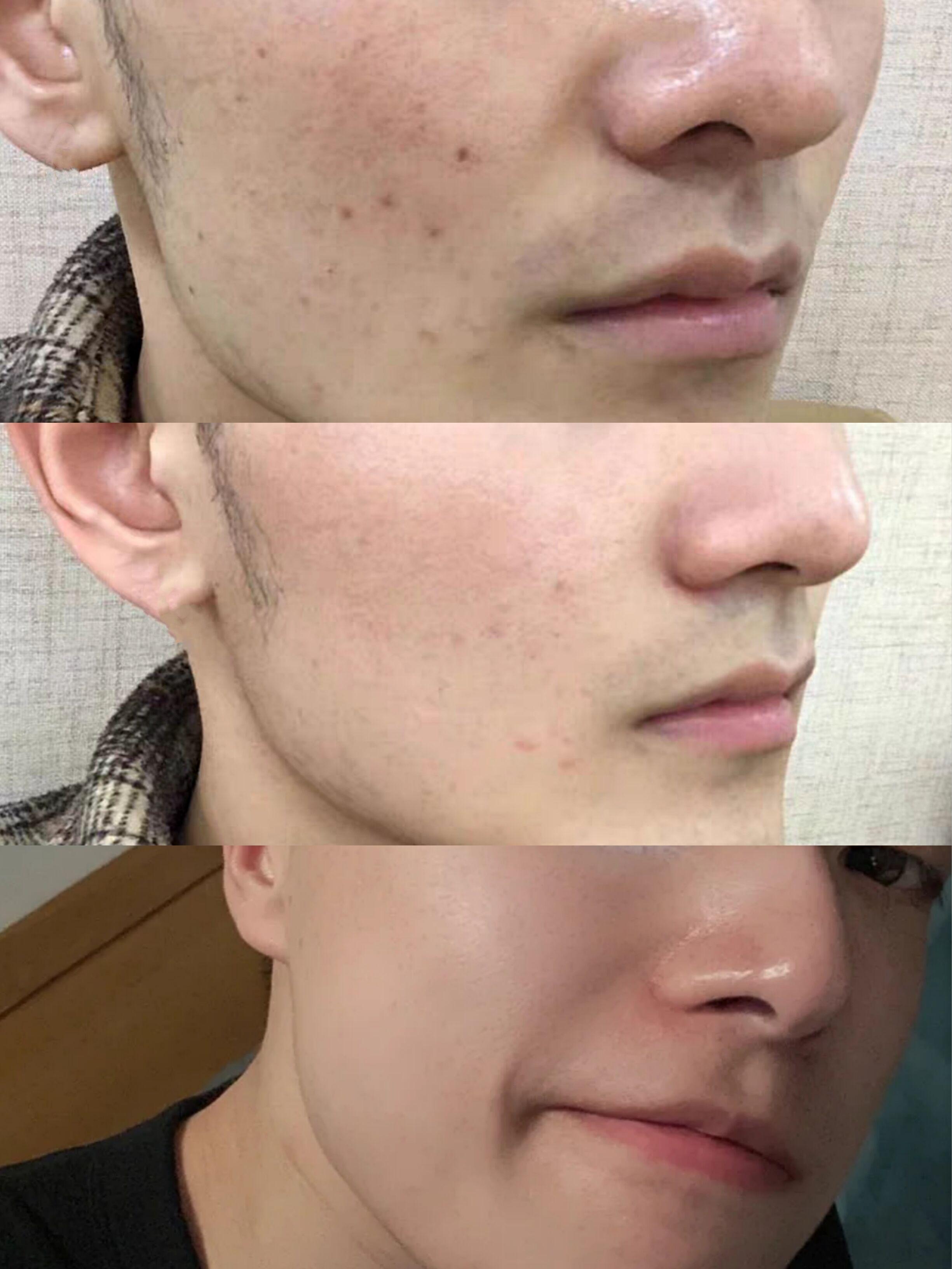 细腻干净的皮肤