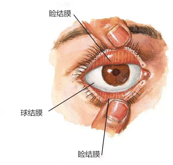 眼结膜是哪个位置图片图片