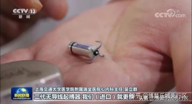 全球最小心脏起搏器解决了ta20余年的房颤问题