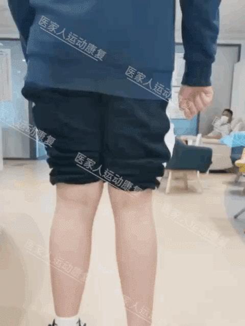 深圳x型腿矯正案例13歲男孩康復一個月重心穩定走路不再搖晃醫家人