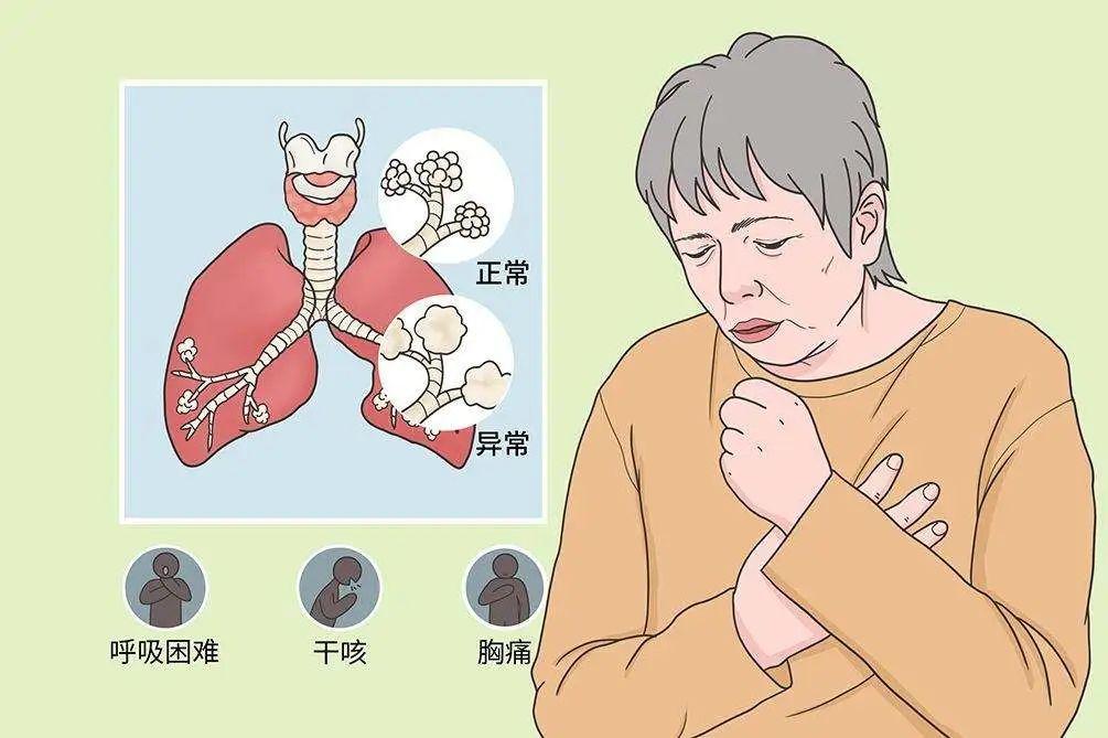 低氧血症的来龙去脉,你了解吗? - 知乎