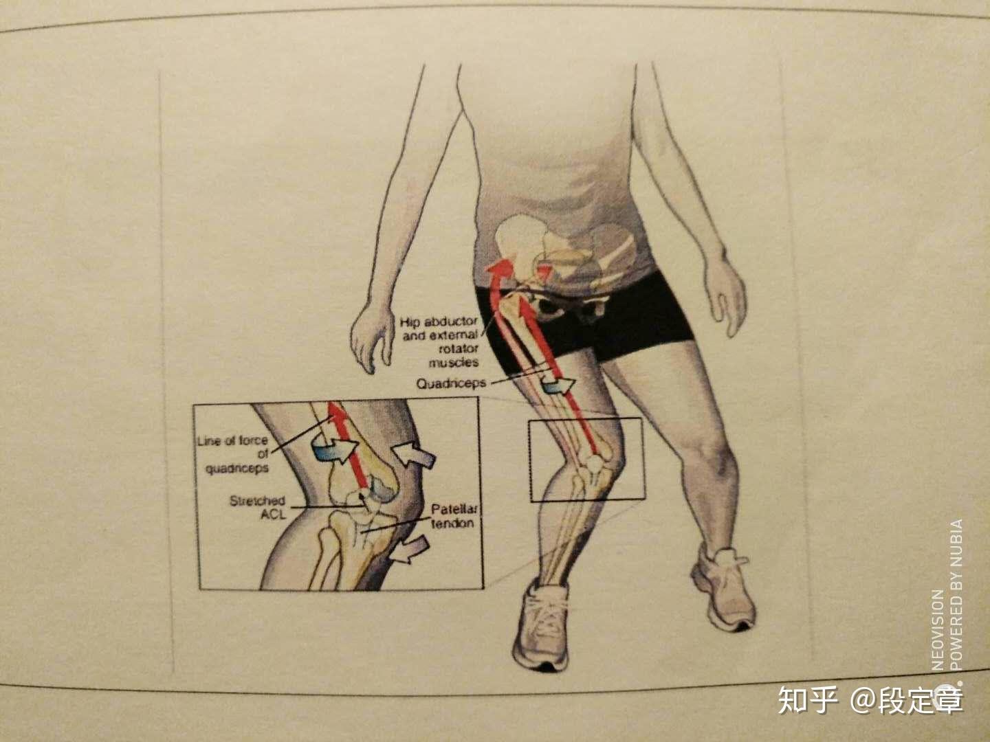 有些患者向后弯腿就是腘窝里面疼,不能下蹲或者下蹲就里面疼.