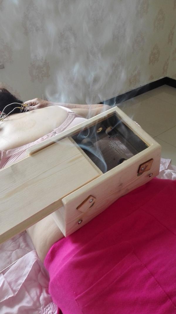 着肤灸(起始)→隔物灸(晋)→艾条实按灸(明)→艾条悬灸(清)