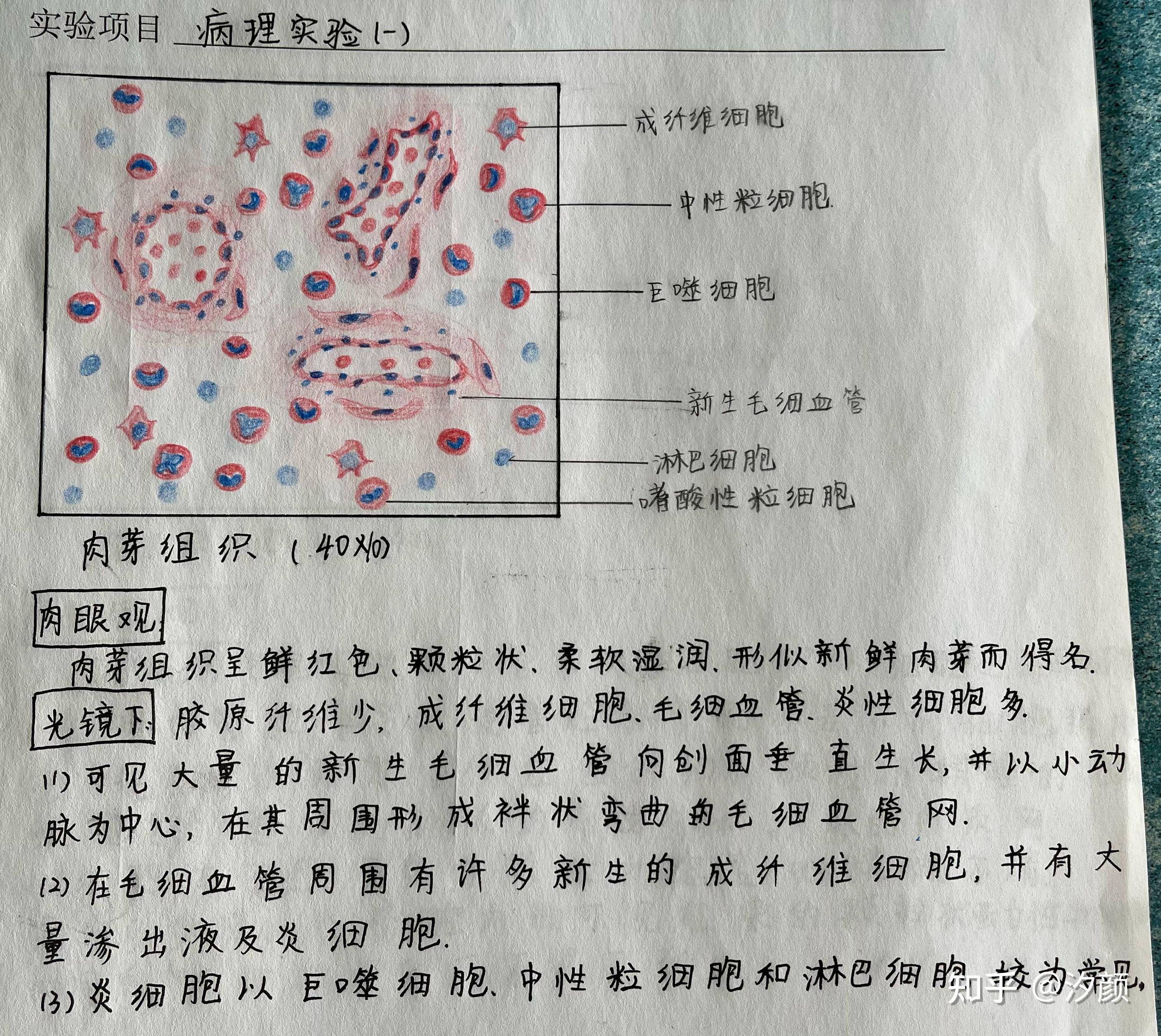 病理学红蓝铅笔手绘图