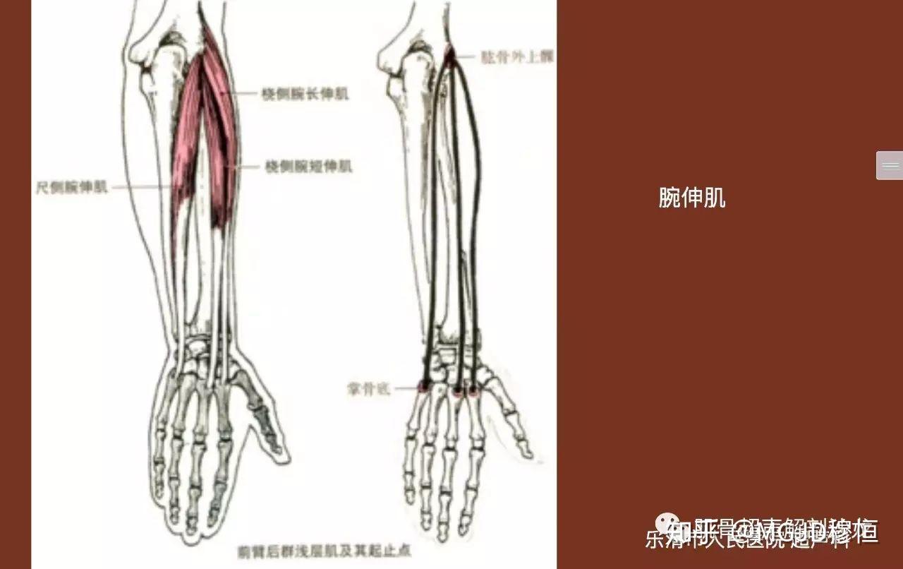 旋前圓肌:兩頭分別起自肱骨內上髁與尺骨冠突,二者之間有正中神經穿過