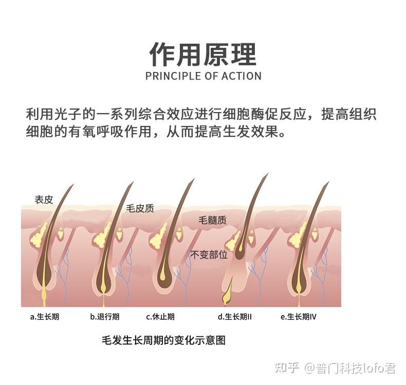 被生活薅走头发的"秃头大军"|深入了解脱发病理和红光光子生发的原理
