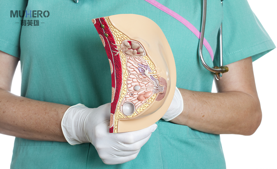 乳腺癌早期症状有哪些